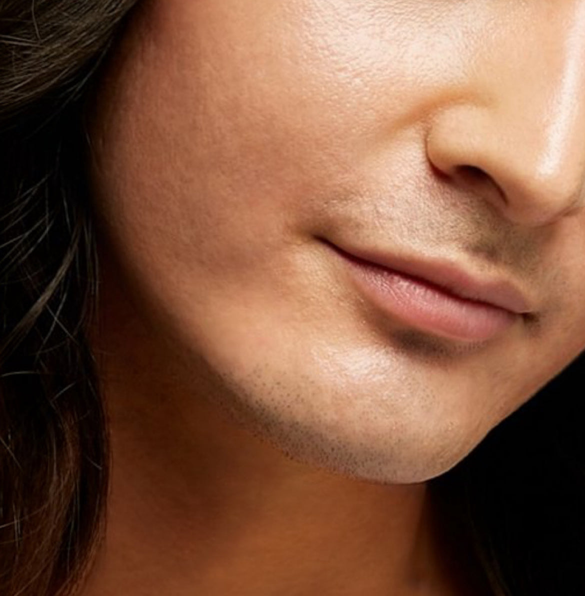 Permanent Hair Removal